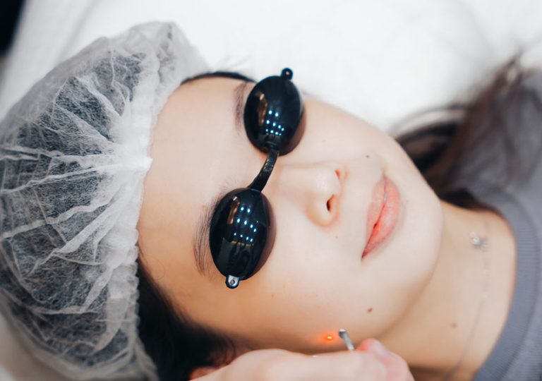 Patient wearing eye shields after treatment