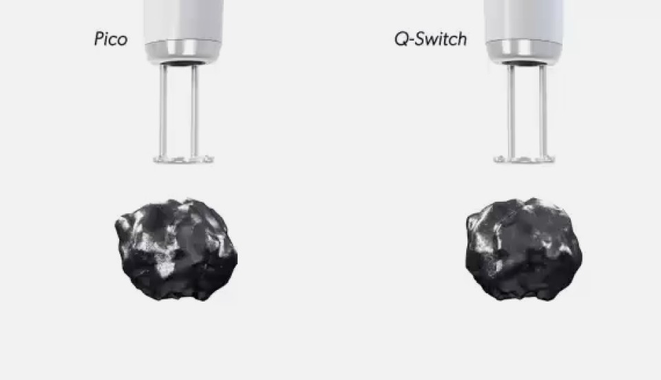 Pico versus Q-Switch handpieces breaking down the same pigment particle
