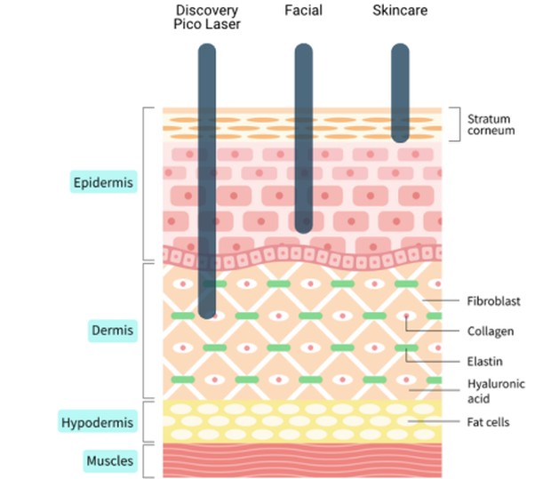 Diagram of skin layers: Discovery Pico Laser reaches the dermis, while facials and skincare stay in the epidermis