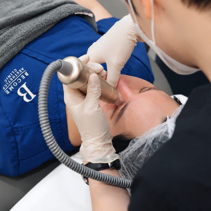 Gold RF microneedling treatment